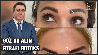 Göz və Alın ətrafı Botoks / Botoks Etdirmək / Dr. Mehdi