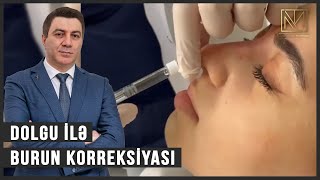 Burun korreksiyası / Dolgu ilə Burun Korreksiyası / Rinoplastika / Dr Mehdi